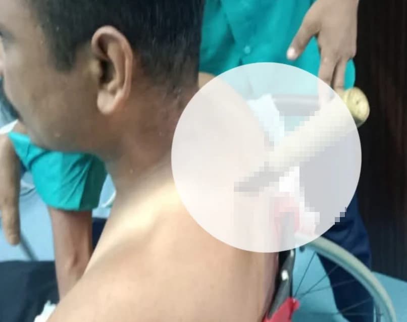 জমি নিয়ে বিবাদ নাকি অন্য কিছু? কক্সবাজারে সৌদি প্রবাসীর ওপর হামলার ঘটনায় চাঞ্চল্য