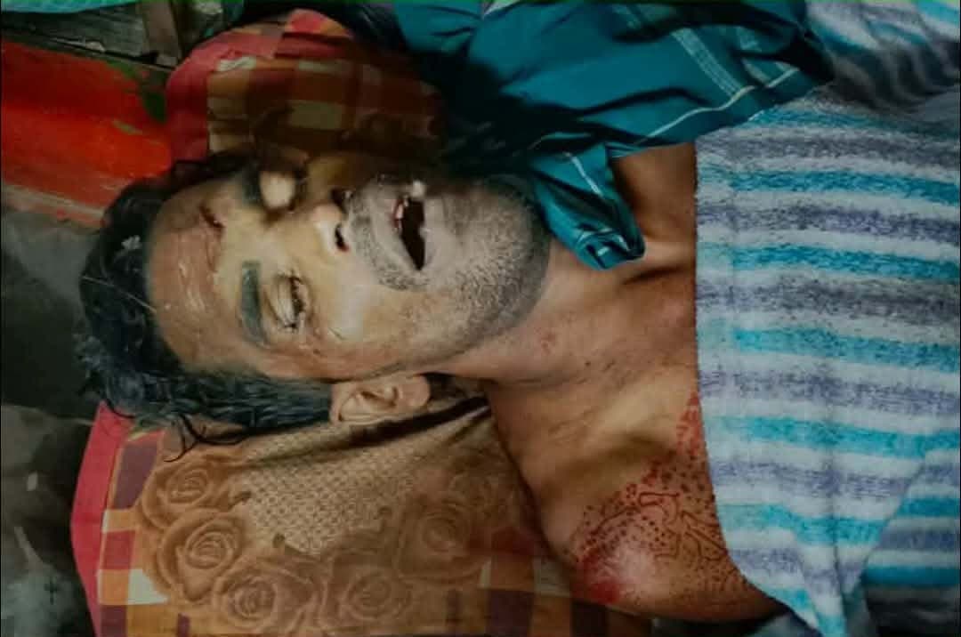 এলোপাথারি কোপে রক্তাক্ত সুমন, মৃত্যুর পর পুকুরে ফেলে পালালো ঘাতকরা: বাকেরগঞ্জে নৃশংস হত্যা