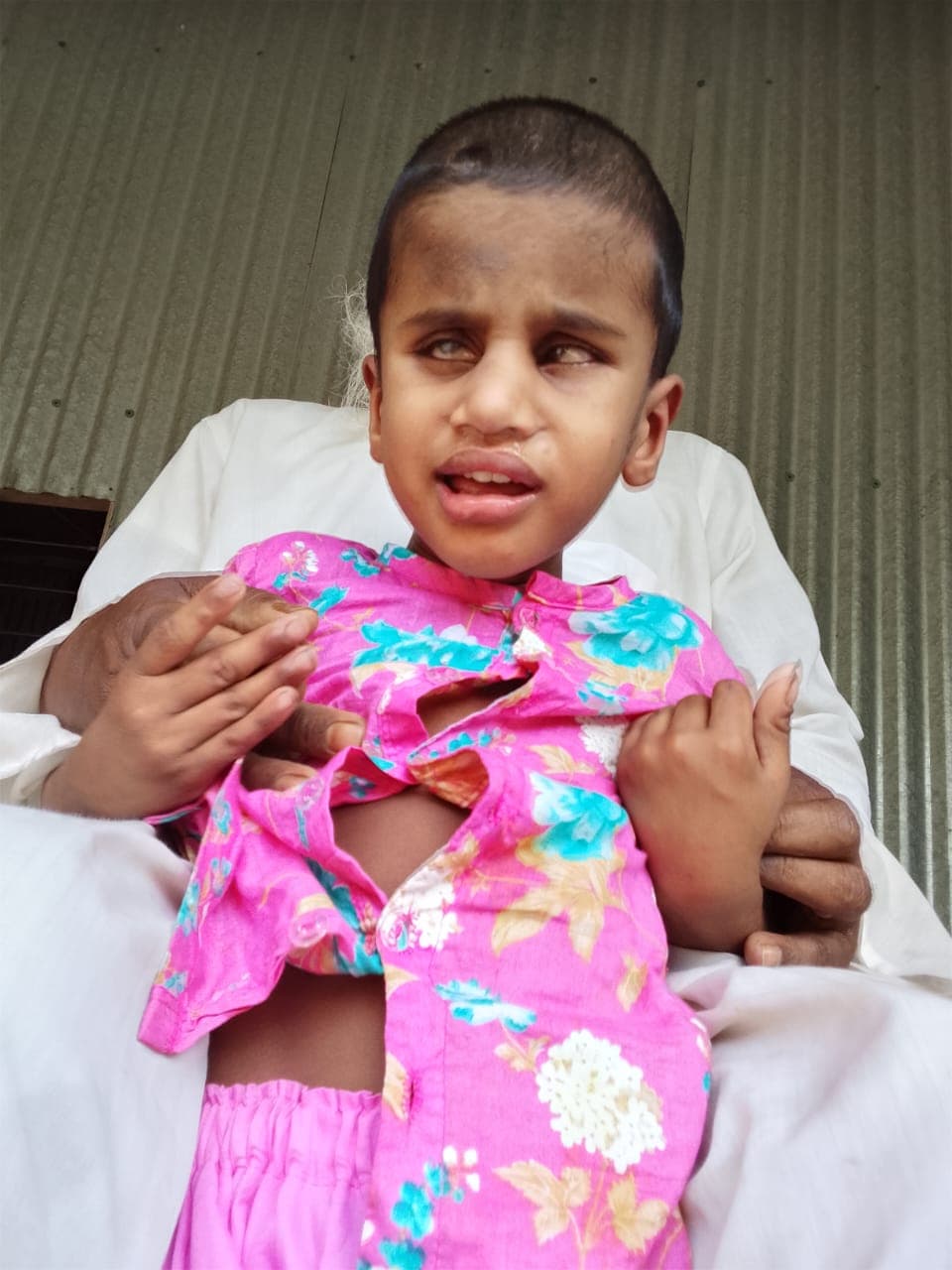মানবিক সাহায্যের আবেদন চোখের জটিল টিউমারে আক্রান্ত ৪ বছরের শিশু ইয়াহইয়া আদনান বাঁচতে চায়