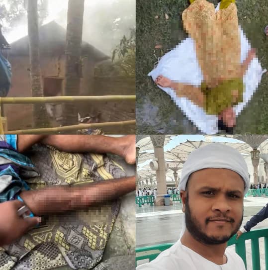 শ্রীপুরে হাসপাতালে ঢুকে প্রবাসী ব্যবসায়ীকে পিটুনি, পা ভেঙে গৃহবধূকে শ্লীলতাহানী
