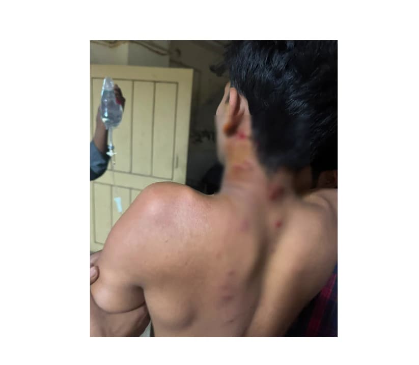 কমলনগরে ব্যবসায়ীর ওপর পরিকল্পিত হামলা,থানায় অভিযোগ