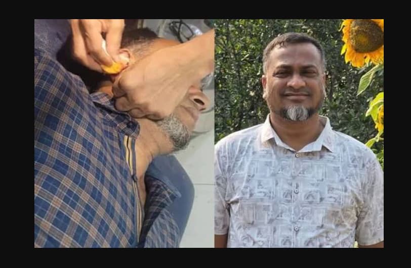 পলাশে ব্যবসায়ীকে অপহরণ করে কানে কামড়, বিএনপি নেতাসহ ১১ জনের বিরুদ্ধে মামলা