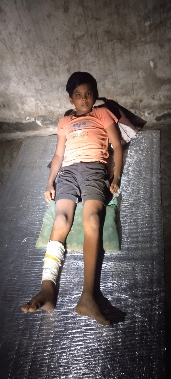 টাকার অভাবে পচে যাচ্ছে ১২ বছরের জুনায়েদের পা, জীবন বাঁচাতে মানবিক সাহায্যের আবেদন