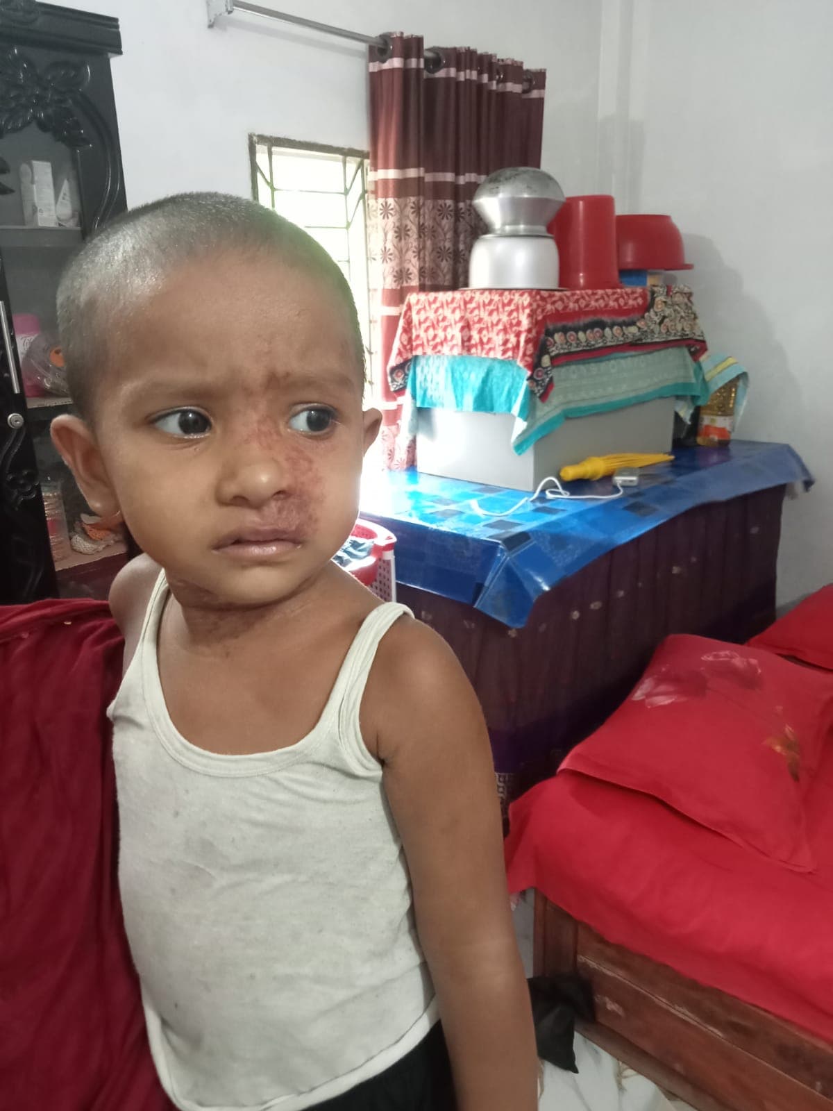 মেয়ের মুখে বিরল টিউমার, চিকিৎসার জন্য একবেলা না খেয়ে দিন গুনছে অসহায় পরিবার