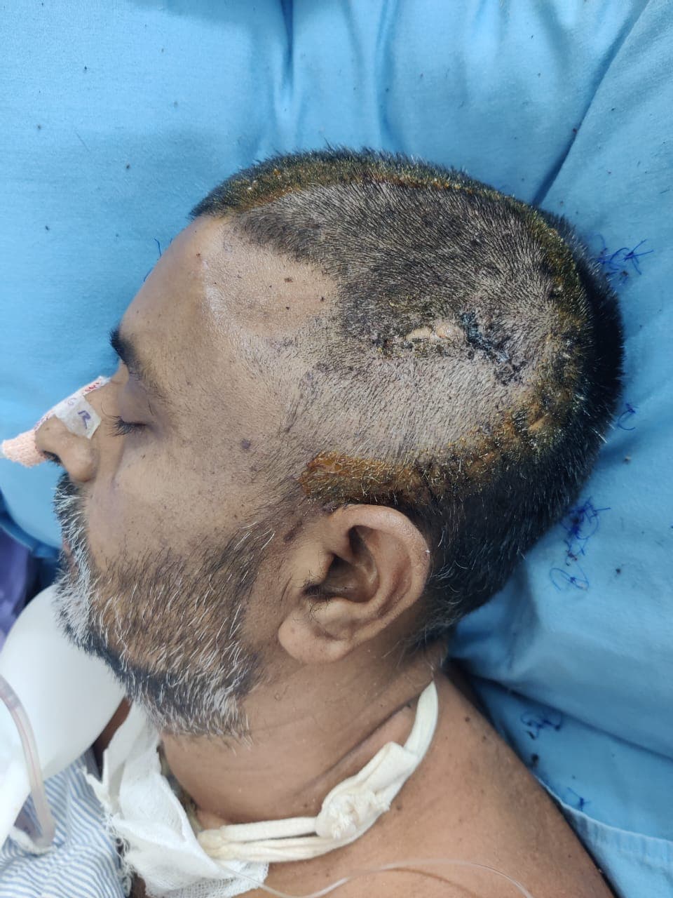 সন্ত্রাসীদের হামলায় ২৬ দিন মৃত্যুর সঙ্গে পাঞ্জা লড়ে না ফেরার দেশে আজিবর